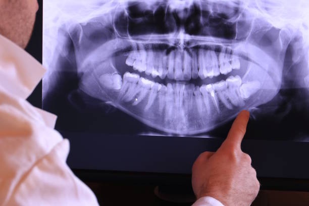 Best Chipped Tooth Repair Near Me  in Ithaca, NY